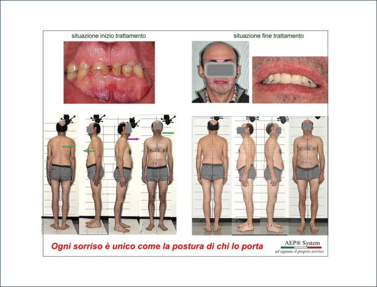 Ogni sorriso è unico come la postura di chi lo porta | Metodo AEP® System