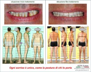 sorriso unico in relazione alla postura e all’equilibrio della persona
