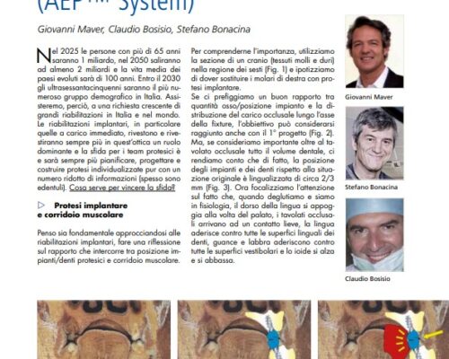 riabilitazione implantare a carico immediato con approccio aep system e gestione dei volumi della bocca