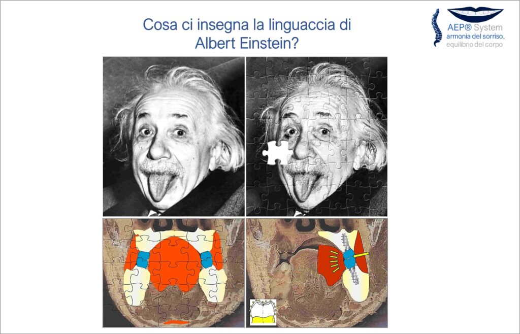 La lingua durante la deglutizione contribuisce all'equilibrio funzionale della bocca secondo il Metodo AEP® System.