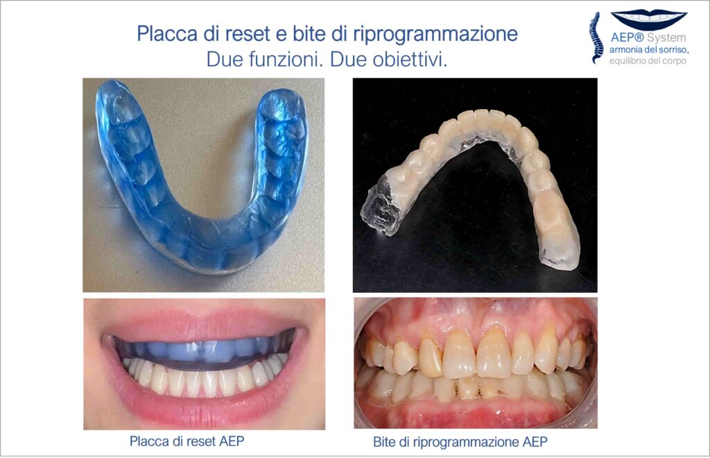 Placca di reset AEP e bite di riprogrammazione AEP con funzioni differenti nel Metodo AEP® System
