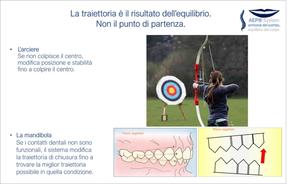 La traiettoria della mandibola è il risultato dell'equilibrio funzionale del sistema, illustrata con la metafora dell'arciere nel Metodo AEP® System.