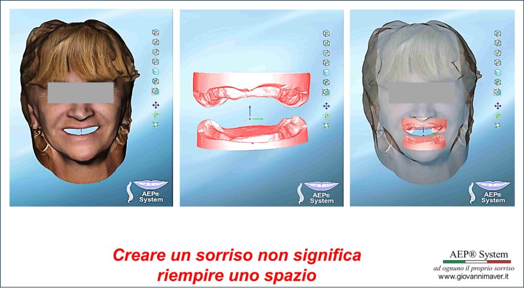 Creare un sorriso nel Metodo AEP® System: relazione tra bocca e postura, viso, arcate dentali e progettazione protesica individuale.