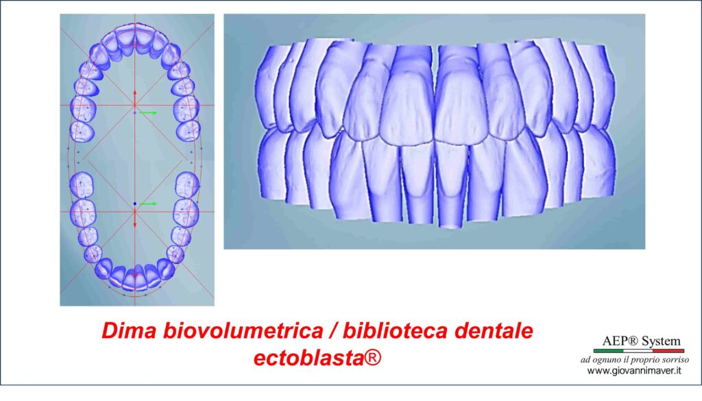Dima Biovolumetrica® e biblioteca dentale AEP® utilizzate come riferimenti nella progettazione personalizzata della morfologia delle arcate dentali.